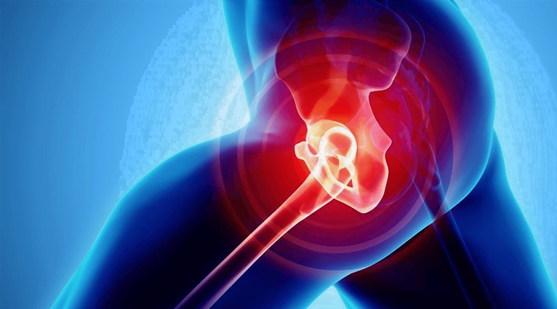 Benefits-of-CBD-for-Hip-Bursitis-wallpaper - Stüdyo Pilates