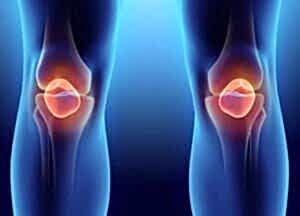 meniscus-yirtigi-1546x1080 - Stüdyo Pilates - Stüdyo Pilates